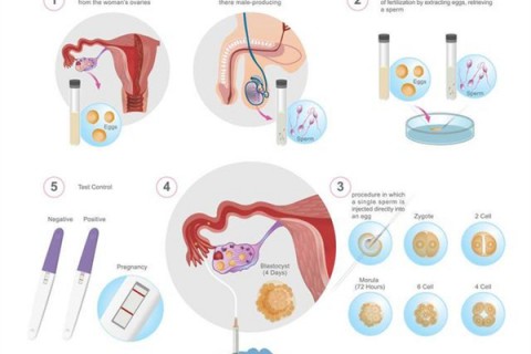 http://huizhou.dacou.net/post/202.html|惠州人工试管